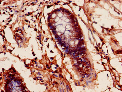 PFDN1 Antibody