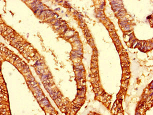 MRPS10 Antibody
