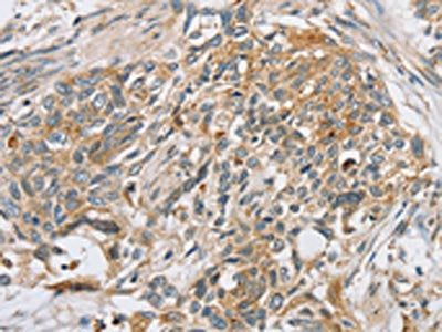 SLC5A6 Antibody