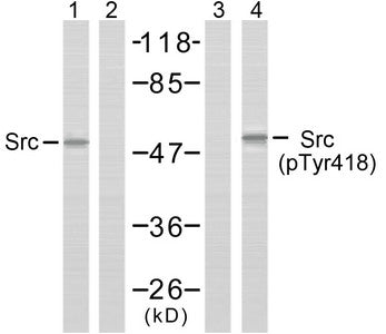 Phospho-SRC (Tyr418) Antibody