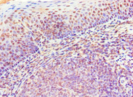 MS4A1 Antibody