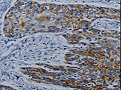 CPT2 Antibody