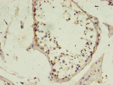 MSH6 Antibody