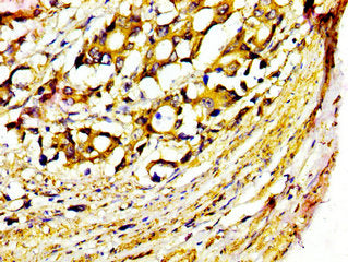 MST1 Antibody