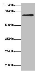 MTHFR Antibody