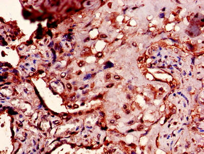 PTMA Antibody