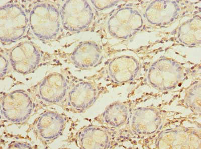 MYADM Antibody