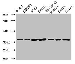 MYF6 Antibody