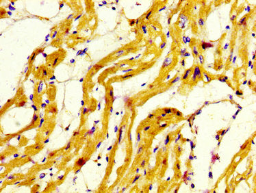 MYH7 Antibody