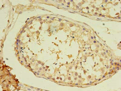 MYH7B Antibody