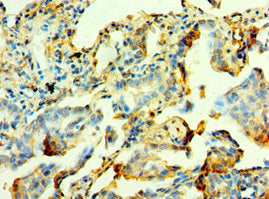 MYOT Antibody