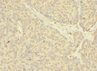 NANOS2 Antibody