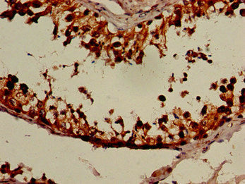 NANOS3 Antibody