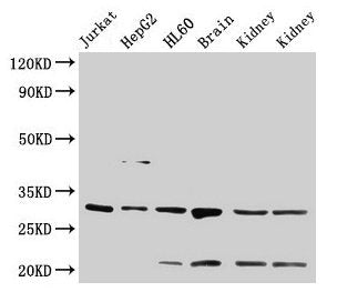 YWHAB Antibody