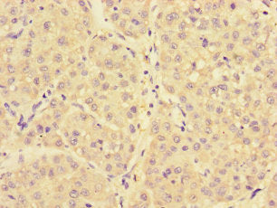 NARS Antibody