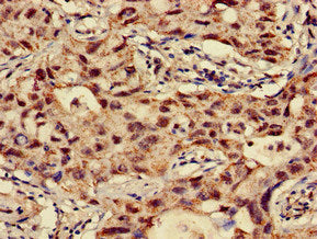 NAT1 Antibody