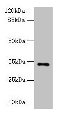 NAT2 Antibody
