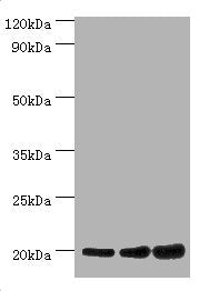 NAA20 Antibody