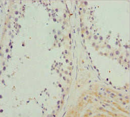 NCALD Antibody