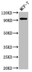 NCAM2 Antibody