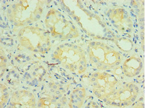 NCOA4 Antibody