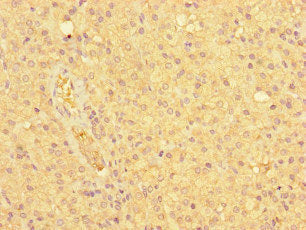 NDC80 Antibody
