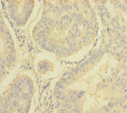 NDUFA6 Antibody