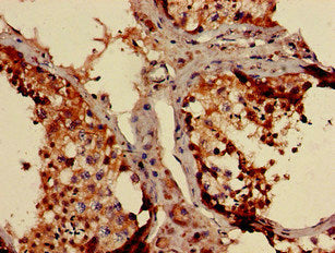 NDUFB3 Antibody