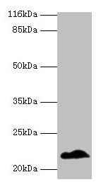 NDUFB5 Antibody