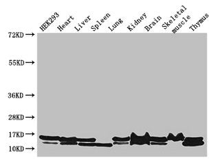 NDUFB6 Antibody