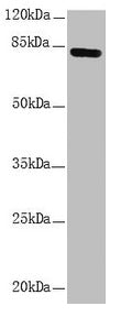 NDUFS1 Antibody