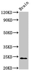 NDUFS8 Antibody