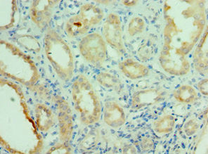 NEK2 Antibody