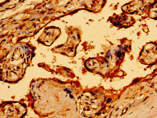 NF1 Antibody