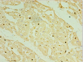 NKX2-5 Antibody