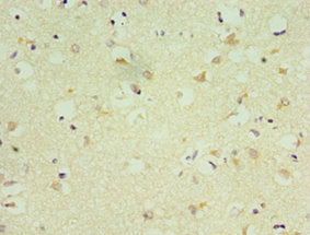NKX2-5 Antibody