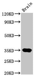 NKX3-2 Antibody