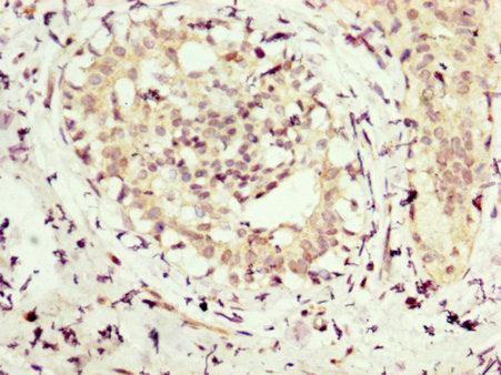 NMT1 Antibody