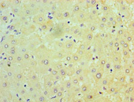 NDUFB7 Antibody