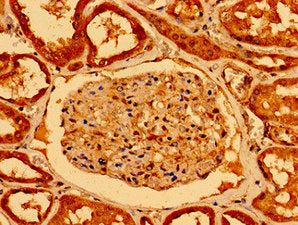 NOTCH2 Antibody
