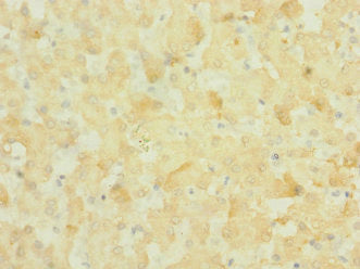 NOX3 Antibody