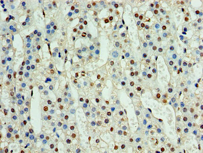 NPHP1 Antibody