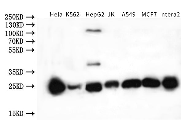 NQO2 Antibody