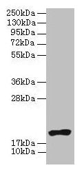 NR2C2AP Antibody