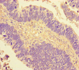 NR2F2 Antibody