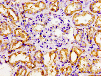 NR2F6 Antibody
