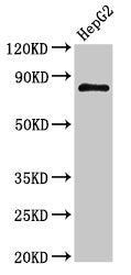 NR3C1 Antibody