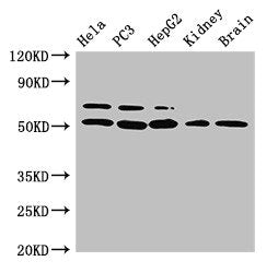 NR5A2 Antibody