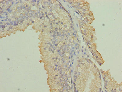 NRARP Antibody