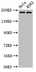NUMA1 Antibody